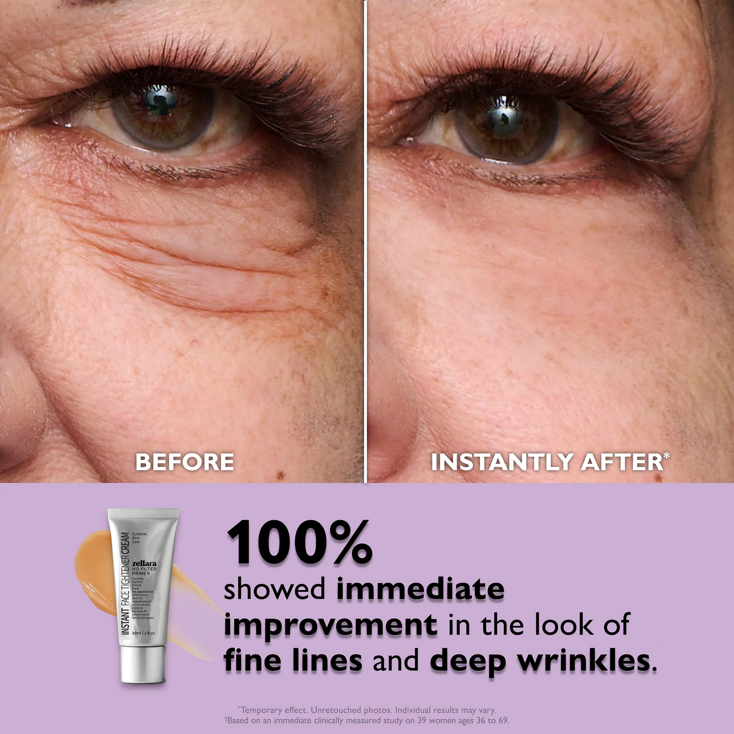 Zellara™ Instant Eye Tightener Cream