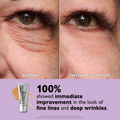 Zellara™ Instant Eye Tightener Cream