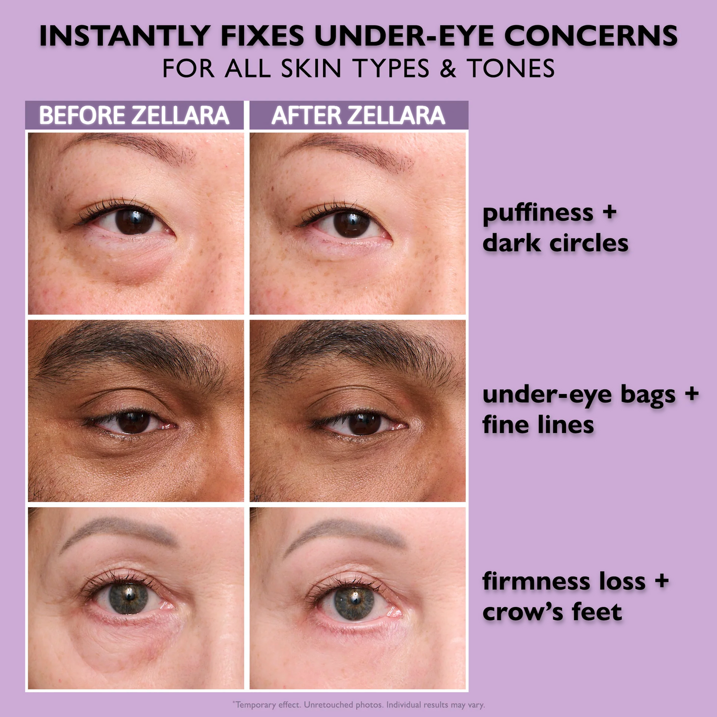 Zellara™ Instant Eye Tightener Cream