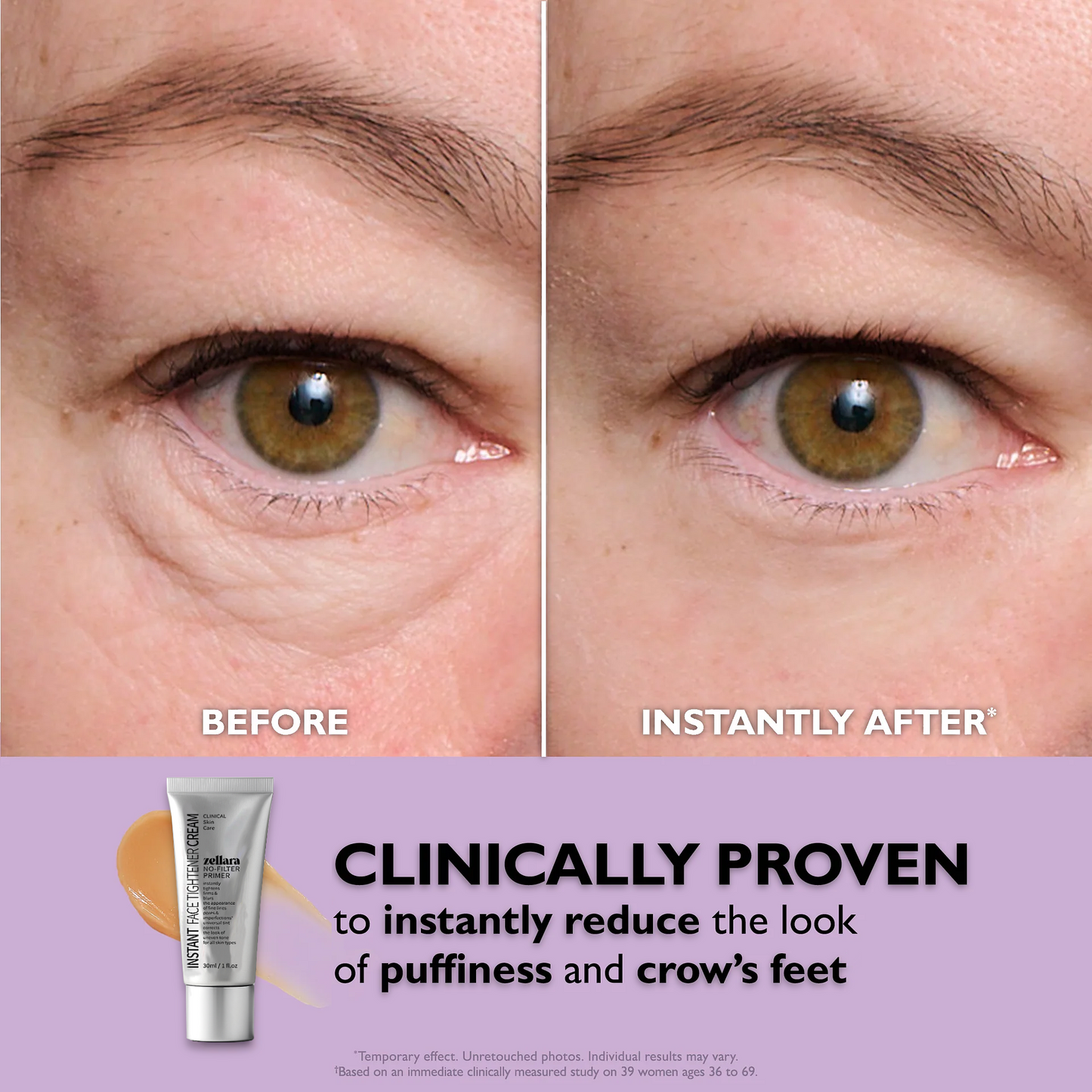 Zellara™ Instant Eye Tightener Cream